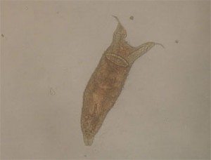 Fish Flukes